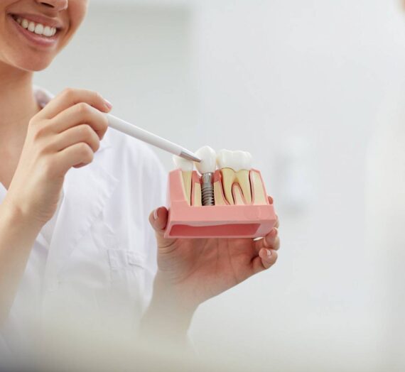 Jak można minimalizować ryzyko powikłań przy implancie zęba?